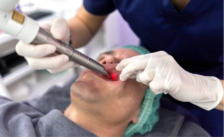 Fotona Laser Snoring Treatment